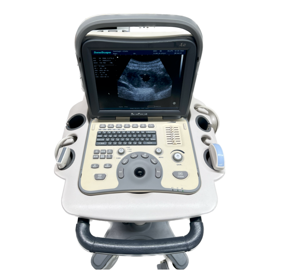 Sonoscape A6 Portable Ultrasound (2 Probes)